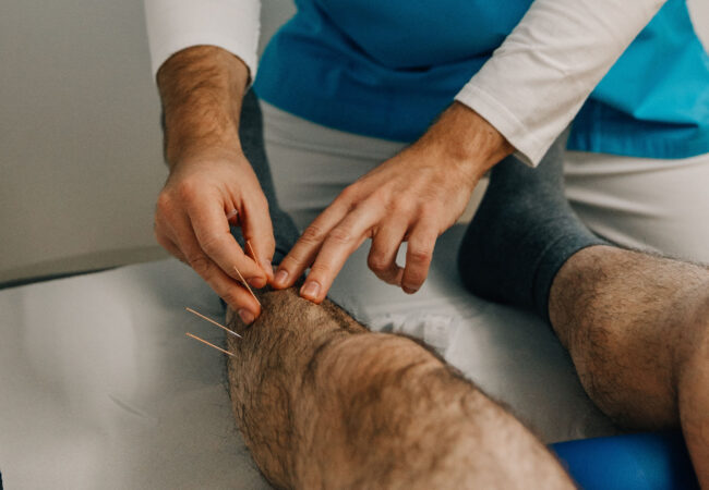 TRIGGERPUNKT-AKUPUNKTUR